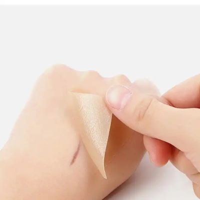 Silikonowe folie, taśma, paski - leczący keloid, cesarskie cięcie, operacja brzucha - leczenie blizn chirurgicznych